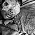 Farshid Tighehsaz - In May 2013, "Kamkar Osmani" has injured because of the remain mine explosion from (Iraq and Iran) war in Sardasht, Kurdestan, Iran. He has lost his left eye. He was born in 2001